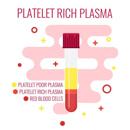 platelet_rich_plasma_59305025_ML_edited